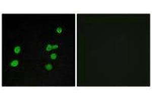 Immunofluorescence analysis of MCF-7 cells, using p97 MAPK antibody. (MAPK6 anticorps)