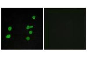 Immunofluorescence analysis of MCF-7 cells, using p97 MAPK antibody.