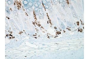 Immunohistochemistry analysis using Mouse Anti-Nitrotyrosine Monoclonal Antibody, Clone 39B6 .