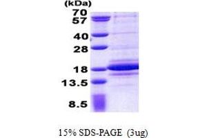 SDS-PAGE (SDS) image for C1D Nuclear Receptor Corepressor (C1D) (AA 1-141) protein (His tag) (ABIN5853022)
