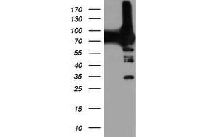 Western Blotting (WB) image for anti-phosphofructokinase, Platelet (PFKP) antibody (ABIN1500166) (PFKP anticorps)