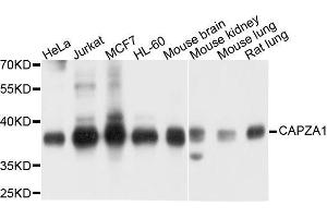 Western blot analysis of extracts of various cell lines, using CAPZA1 antibody. (CAPZA1 anticorps  (AA 1-286))