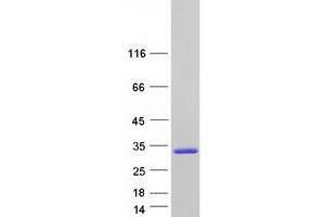Validation with Western Blot