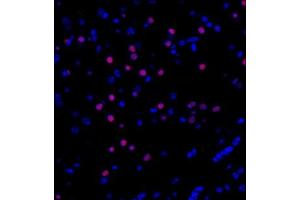 Immunofluorescent analysis of paraffin embedded mouse hippocampus using ZFPM2 (ABIN7076277) at dilution of 1: 300
