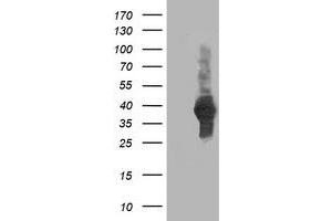 Western Blotting (WB) image for anti-ATG3 Autophagy Related 3 (ATG3) antibody (ABIN1496762)