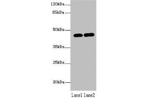 Western blot All lanes: LMNTD1 antibody at 12 μg/mL Lane 1: MCF-7 whole cell lysate Lane 2: Mouse liver tissue Secondary Goat polyclonal to rabbit IgG at 1/10000 dilution Predicted band size: 44, 34, 37, 42, 46 kDa Observed band size: 44 kDa (PAS1C1 anticorps  (AA 113-291))