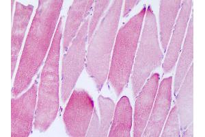 Anti-NDUFAF2 / NDUFA12L antibody IHC of human skeletal muscle.