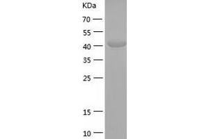 Western Blotting (WB) image for Dynactin 2 (p50) (DCTN2) (AA 1-406) protein (His tag) (ABIN7122716) (Dynamitin Protein (AA 1-406) (His tag))
