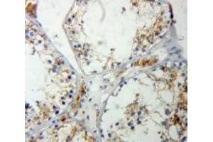 Used in DAB staining on fromalin fixed paraffin-embedded Testis tissue (RASA1 anticorps  (AA 403-596))