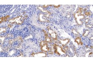 Detection of Slit3 in Porcine Kidney Tissue using Polyclonal Antibody to Slit Homolog 3 (Slit3)