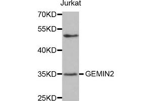 Western blot analysis of extracts of Jurkat cells, using GEMIN2 antibody. (SIP1 anticorps)