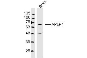 Mouse Brain lysates probed with APLP1 Polyclonal Antibody, Unconjugated  at 1:300 dilution and 4˚C overnight incubation. (APLP1 anticorps  (AA 1-100))