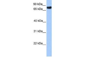 WB Suggested Anti-TLE2 Antibody Titration:  0. (TLE2 anticorps  (N-Term))
