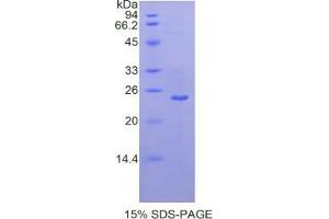 SDS-PAGE analysis of Human MMP13 Protein. (MMP13 Protéine)