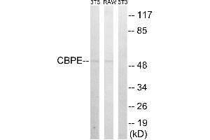 Western blot analysis of extracts from 3T3 cells and RAW264. (CPE anticorps)