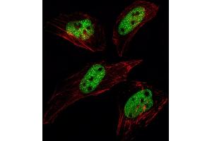 Fluorescent image of Hela cell stained with SUMO1 Antibody (N-term E67) (ABIN1882137 and ABIN2845494)/SH030609A. (SUMO1 anticorps  (N-Term))