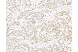 Immunohistochemistry (IHC) image for anti-Histone H3 (H3) (C-Term) antibody (ABIN7455227)