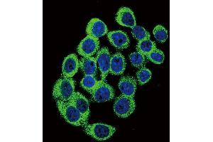 Confocal immunofluorescent analysis of ATXN1 Antibody  (ABIN389309 and ABIN2839430) with hela cell followed by Alexa Fluor 488-conjugated goat anti-rabbit lgG (green).