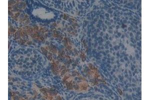 Detection of GSTt2 in Mouse Ovary Tissue using Polyclonal Antibody to Glutathione S Transferase Theta 2 (GSTt2)