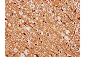 IHC image of ABIN7168370 diluted at 1:300 and staining in paraffin-embedded human brain tissue performed on a Leica BondTM system. (MEX3A anticorps  (AA 416-466))