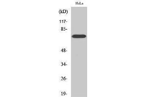 Western Blotting (WB) image for anti-V-Raf-1 Murine Leukemia Viral Oncogene Homolog 1 (RAF1) (Thr56) antibody (ABIN3177115) (RAF1 anticorps  (Thr56))