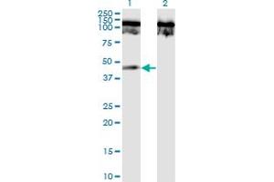 Western Blotting (WB) image for anti-Tumor Necrosis Factor Receptor Superfamily, Member 19 (TNFRSF19) (AA 30-120) antibody (ABIN793041) (TNFRSF19 anticorps  (AA 30-120))