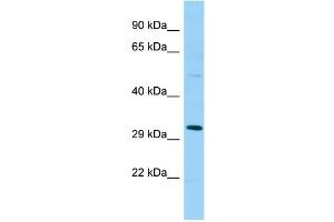 WB Suggested Anti-SPSB1 Antibody Titration: 1. (SPSB1 anticorps  (Middle Region))
