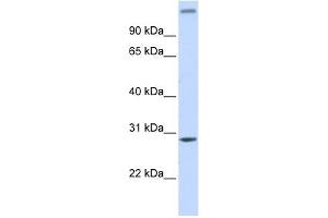 ALKBH2 antibody used at 1 ug/ml to detect target protein. (ALKBH2 anticorps)