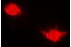 Immunofluorescent analysis of USP7 staining in Hela cells. (USP7 anticorps)
