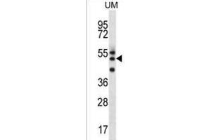 RMD2 Antibody (Center) (ABIN1538003 and ABIN2849325) western blot analysis in uterus tumor cell line lysates (35 μg/lane). (FAM82A1 anticorps  (AA 188-216))