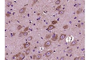Paraformaldehyde-fixed, paraffin embedded rat brain, Antigen retrieval by boiling in sodium citrate buffer (pH6) for 15min, Block endogenous peroxidase by 3% hydrogen peroxide for 30 minutes, Blocking buffer (normal goat serum) at 37°C for 20min, Antibody incubation with Versican Polyclonal Antibody (bs-2533R) at 1:400 overnight at 4°C, followed by a conjugated secondary and DAB staining