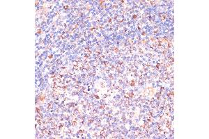 Immunohistochemistry of paraffin-embedded human tonsil using VHL antibody (ABIN3020967, ABIN3020968, ABIN3020969 and ABIN6213828) at dilution of 1:200 (40x lens). (VHL anticorps  (AA 1-172))