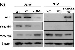 Aryl hydrocarbon receptor (AhR) expression in different cells was correlated with E-cadherin and vimentin expression and cell motility. (Vimentin anticorps)