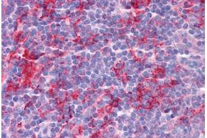 Human Tonsil: Formalin-Fixed, Paraffin-Embedded (FFPE) (KLHL25 anticorps  (Internal Region))