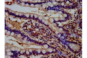 IHC image of ABIN7167082 diluted at 1:500 and staining in paraffin-embedded human small intestine tissue performed on a Leica BondTM system.