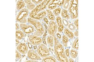 Immunohistochemistry of paraffin-embedded rat kidney using SLC12 Rabbit pAb (ABIN6131136, ABIN6147843, ABIN6147844 and ABIN6215366) at dilution of 1:50 (40x lens). (SLC12A2 anticorps  (AA 120-280))