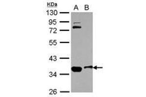 Image no. 1 for anti-Osteopetrosis Associated Transmembrane Protein 1 (OSTM1) (AA 1-334) antibody (ABIN1499928) (OSTM1 anticorps  (AA 1-334))