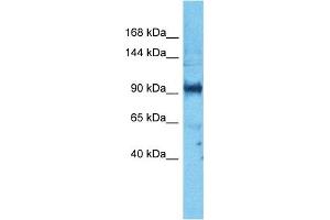 Host:  Rabbit  Target Name:  PARD3  Sample Type:  PANC1 Whole Cell lysates  Antibody Dilution:  1. (PARD3 anticorps  (N-Term))