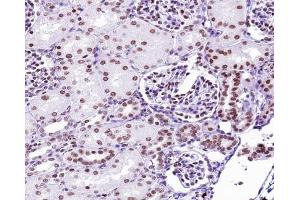 ABIN6267291 at 1/200 staining human kidney tissue sections by IHC-P.