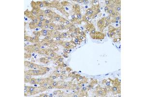 Immunohistochemistry of paraffin-embedded human liver using CCM2 antibody at dilution of 1:100 (x40 lens).