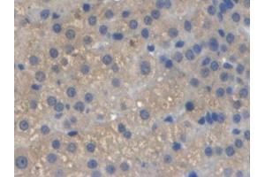 Detection of a1AGP in Rat Prostate Tissue using Monoclonal Antibody to Alpha-1-Acid Glycoprotein (a1AGP)