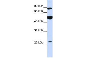 WB Suggested Anti-GCS1 Antibody Titration:  0.
