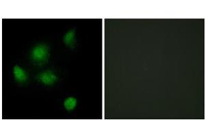 Immunofluorescence analysis of HeLa cells, using SIN3B antibody. (SIN3B anticorps  (Internal Region))