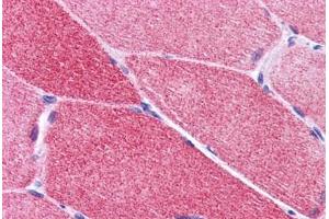 Human Skeletal Muscle: Formalin-Fixed, Paraffin-Embedded (FFPE) (PLEKHM2 anticorps  (C-Term))