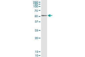 Immunoprecipitation of PLA1A transfected lysate using anti-PLA1A MaxPab rabbit polyclonal antibody and Protein A Magnetic Bead , and immunoblotted with PLA1A purified MaxPab mouse polyclonal antibody (B01P) .