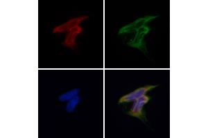 ABIN6257207 and ABIN6275954 staining Hela by IF/ICC. (G Protein-Coupled Receptor 119 anticorps  (Internal Region))