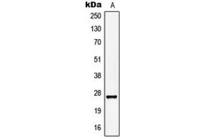Western blot analysis of KCNMB2 expression in HepG2 (A) whole cell lysates.