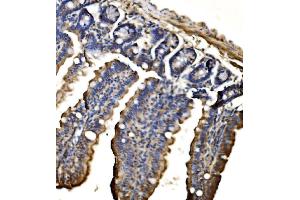 IHC analysis of CPS1 using anti-CPS1 antibody (ABIN7599871). (CPS1 anticorps  (AA 124-379))