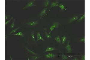 Immunofluorescence of purified MaxPab antibody to FNTA on HeLa cell. (FNTA anticorps  (AA 1-214))