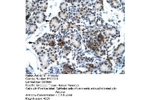 Human Pancrease (ETS1 anticorps  (N-Term))